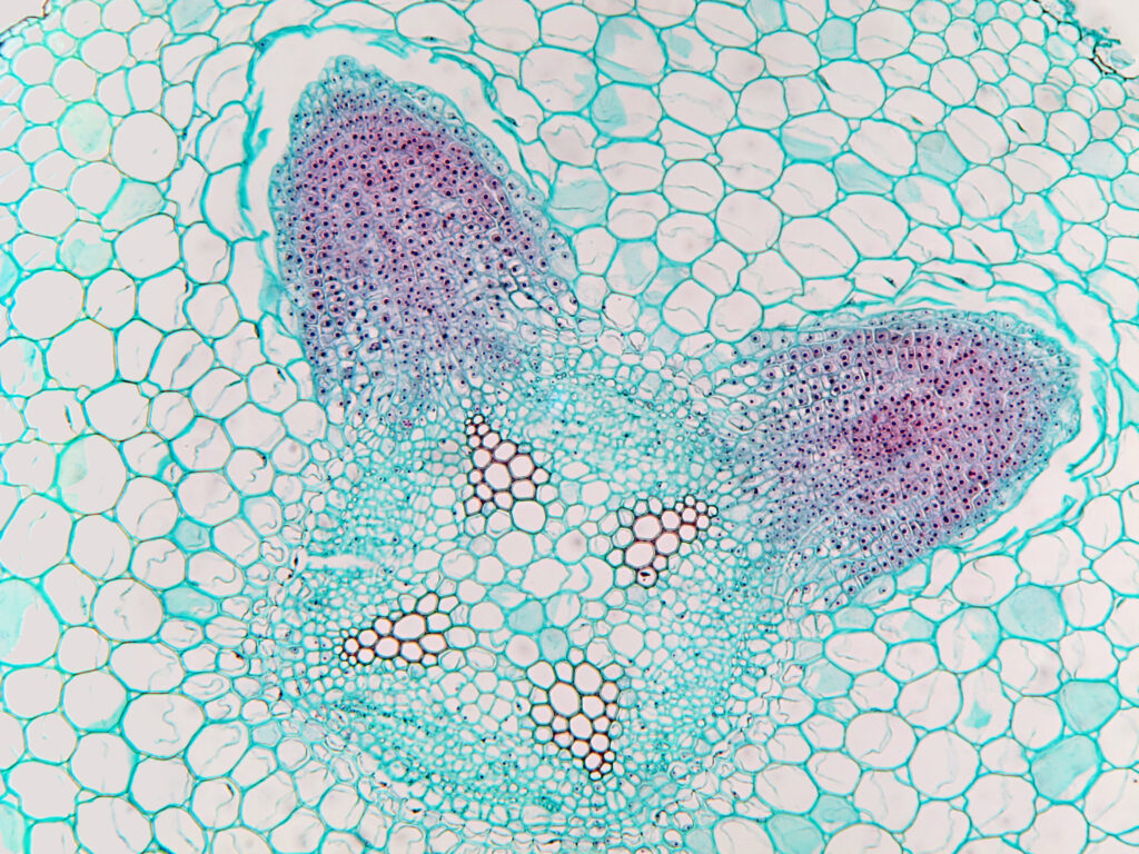 A soy root nodule under a microscope