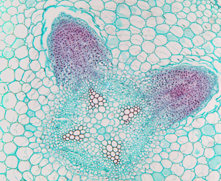 A soy root nodule under a microscope