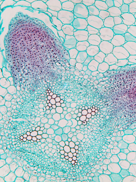 A soy root nodule under a microscope